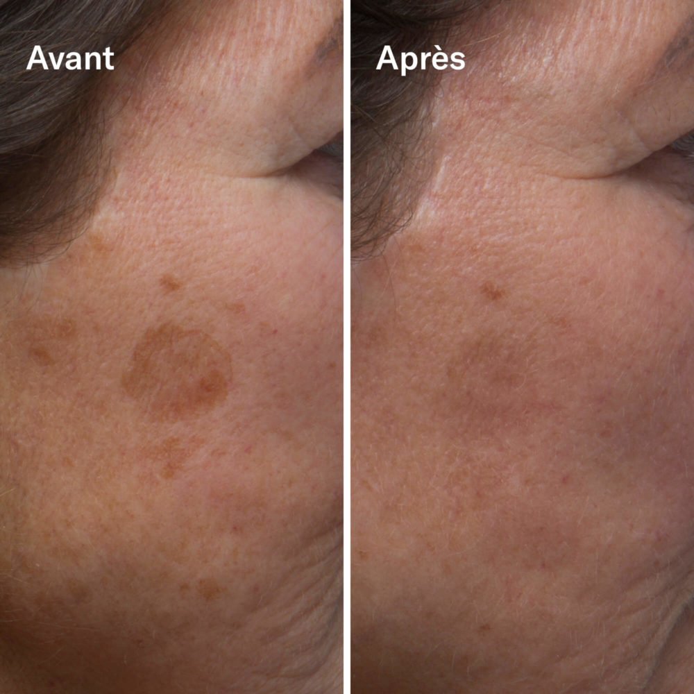 Clean-ical Brightening Serum - Image 2