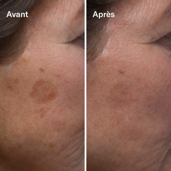 Clean-ical Brightening Serum - Image 2