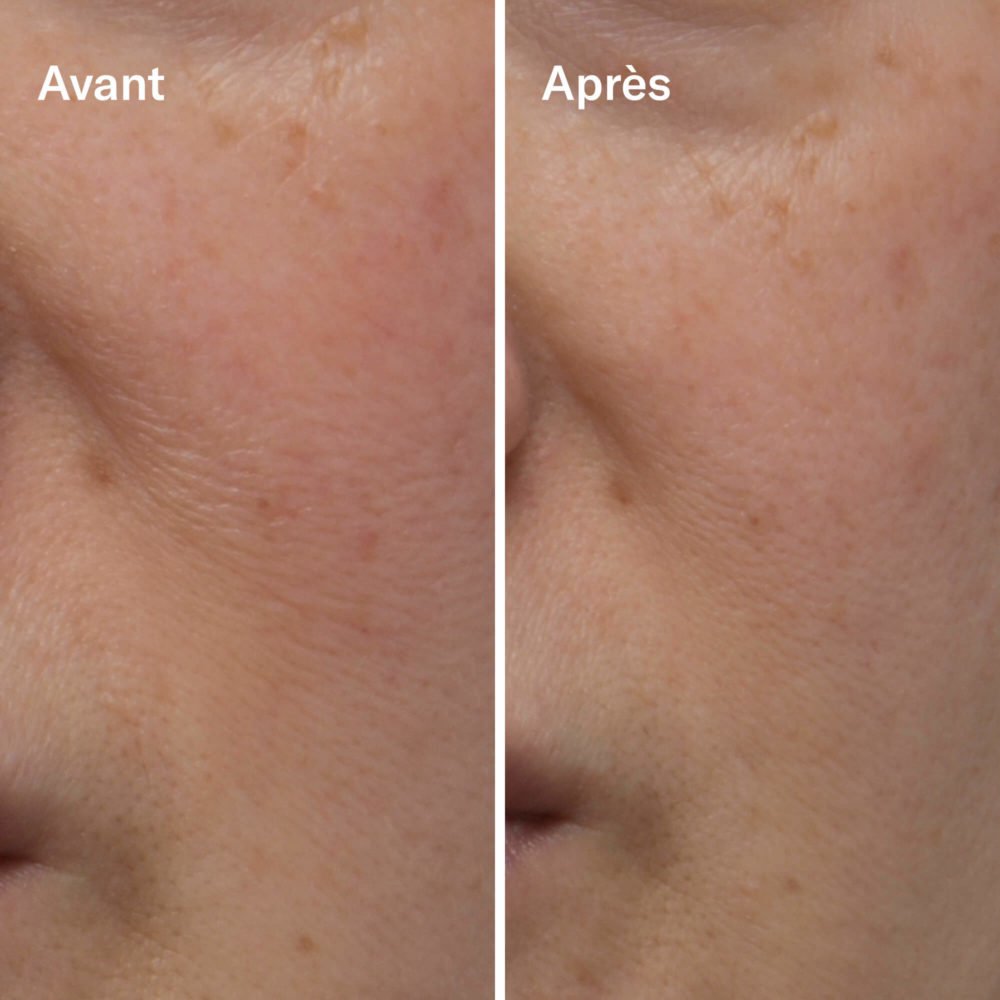 Clean-ical Brightening Serum - Image 3