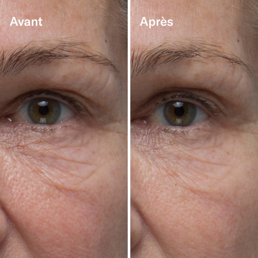 Clean-ical Renewing Serum - Image 3