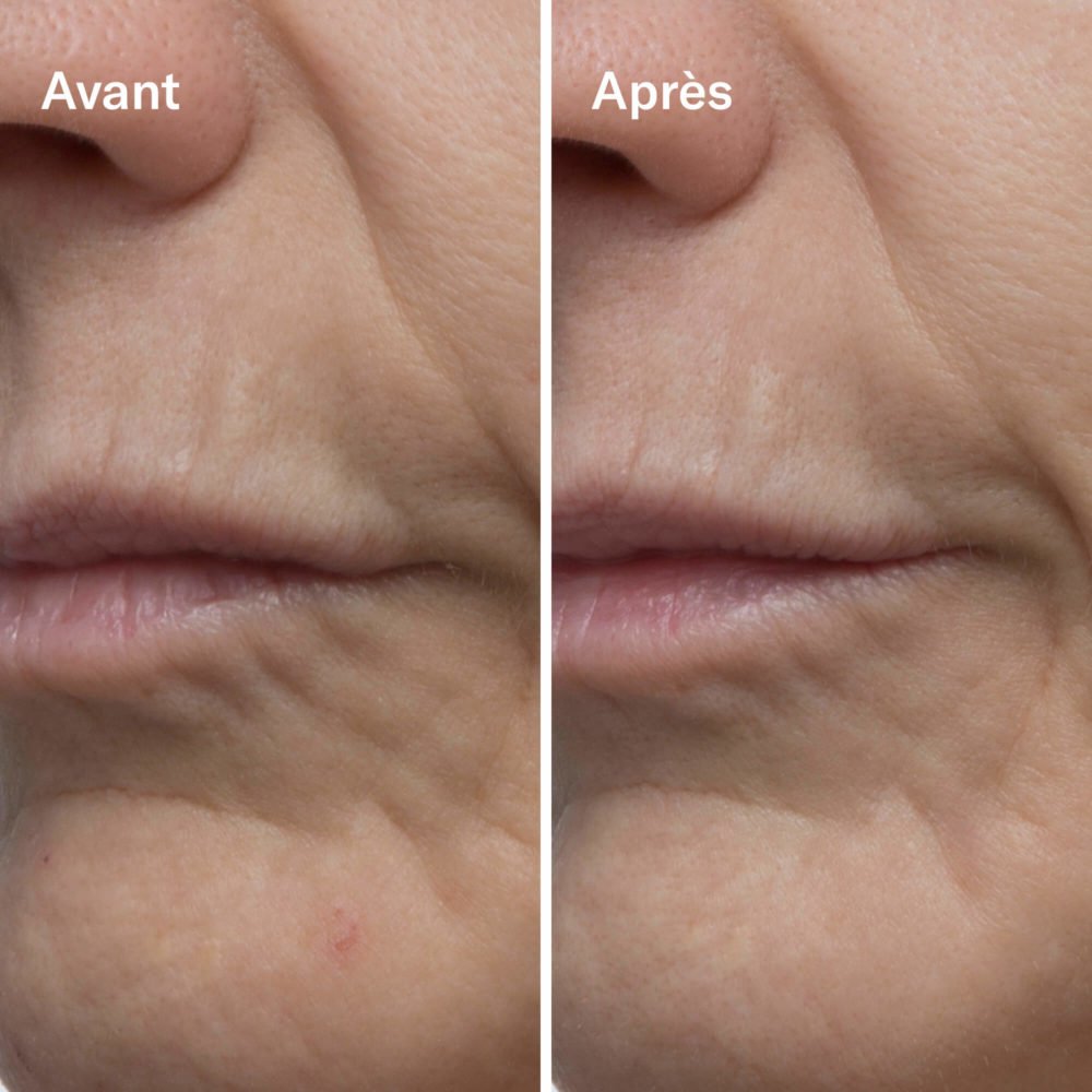 Clean-ical Renewing Serum - Image 4