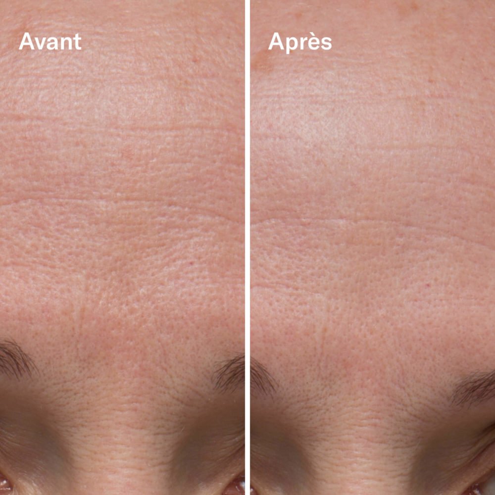 Clean-ical Renewing Serum - Image 5
