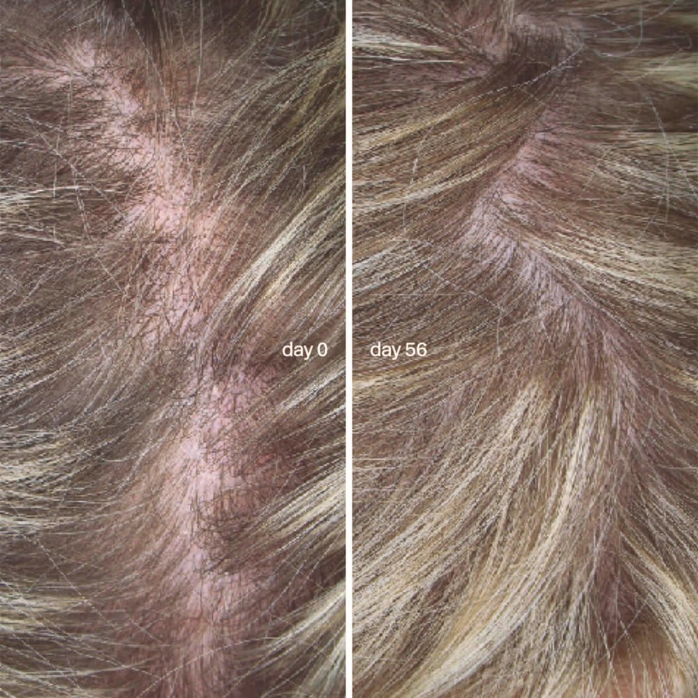 L'Essentiel Cheveux Hair Growth Supplement - Image 4